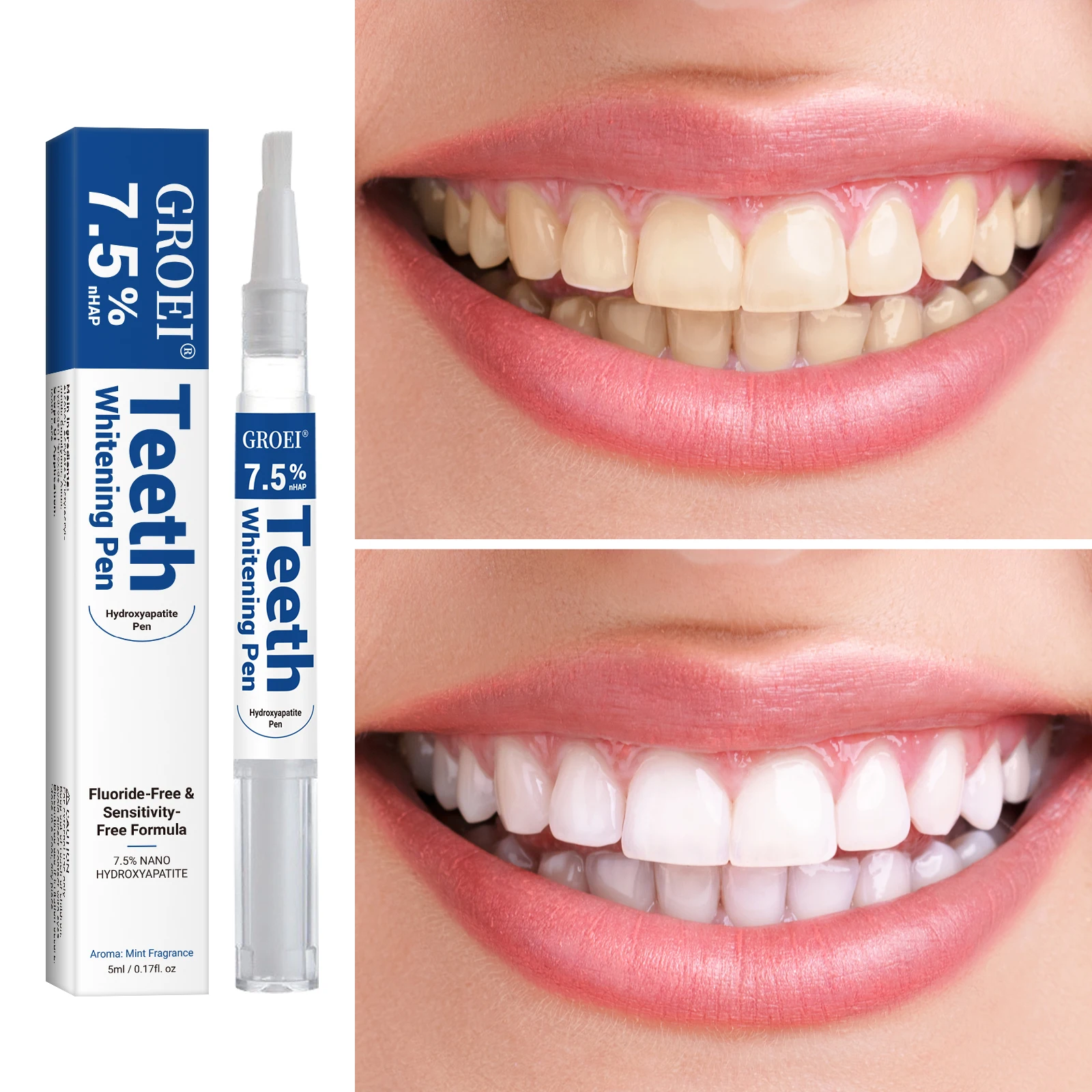 Hydroxyapatite Tooth Whitening - Teeth Whitening Gel Peroxide 评论和价格