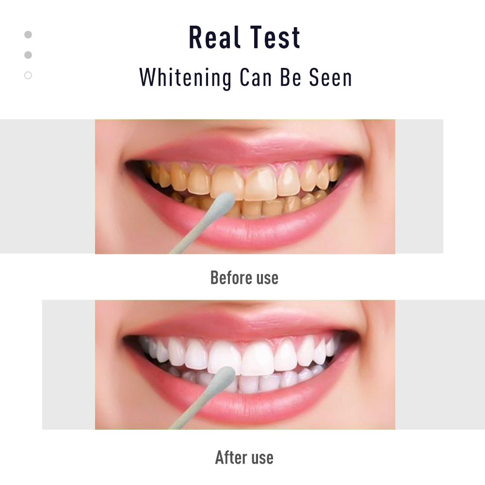 Pen Tooth Gel White  Kit Clean - Whitening Pen Bleach 评论和价格