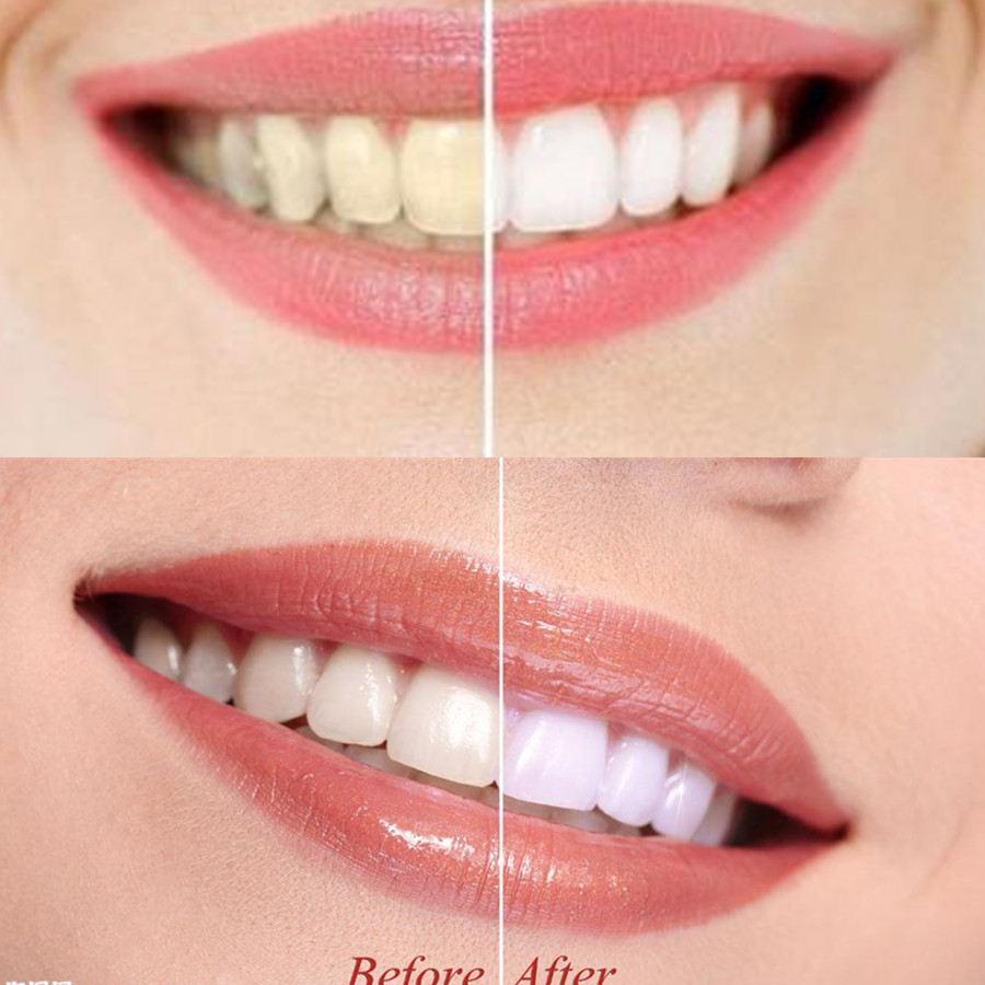 Bamboo Charcoal Teeth Tooth De - Teeth Whitening Co 评论和价格