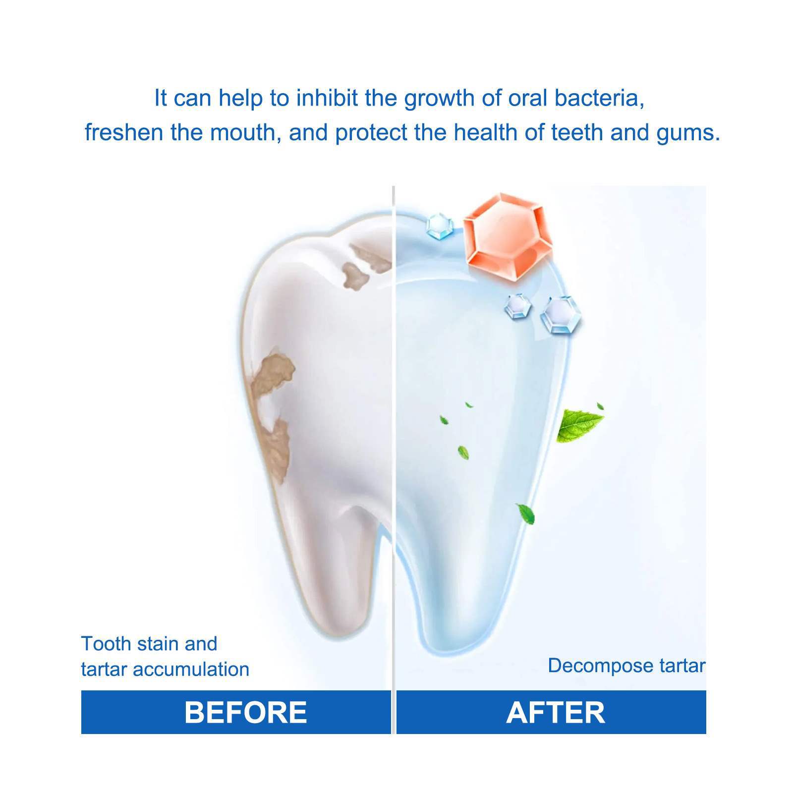 Teeth Whitening Essence Remove - Teeth Whitening Serum 评论和价格