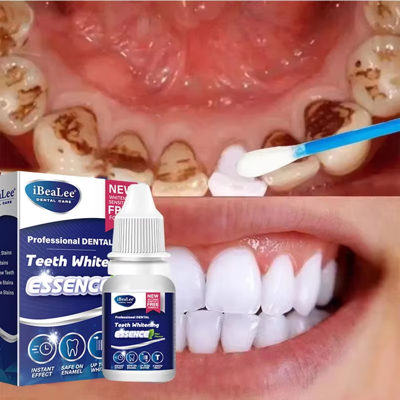 Teeth Whitening Essence Remove - Teeth Whitening Serum 评论和价格