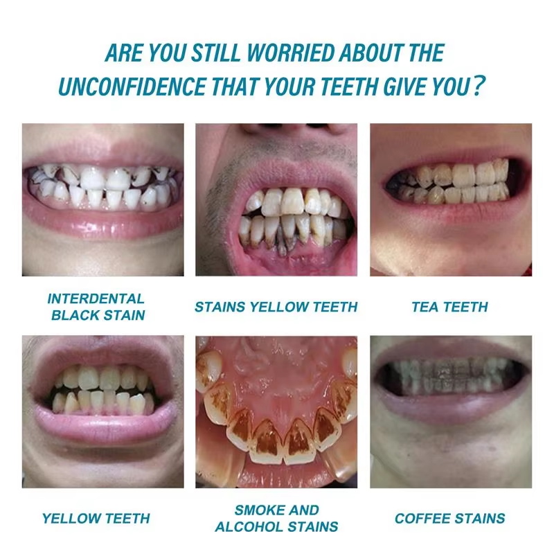Teeth Whitening Essence Remove - Teeth Whitening Serum 评论和价格