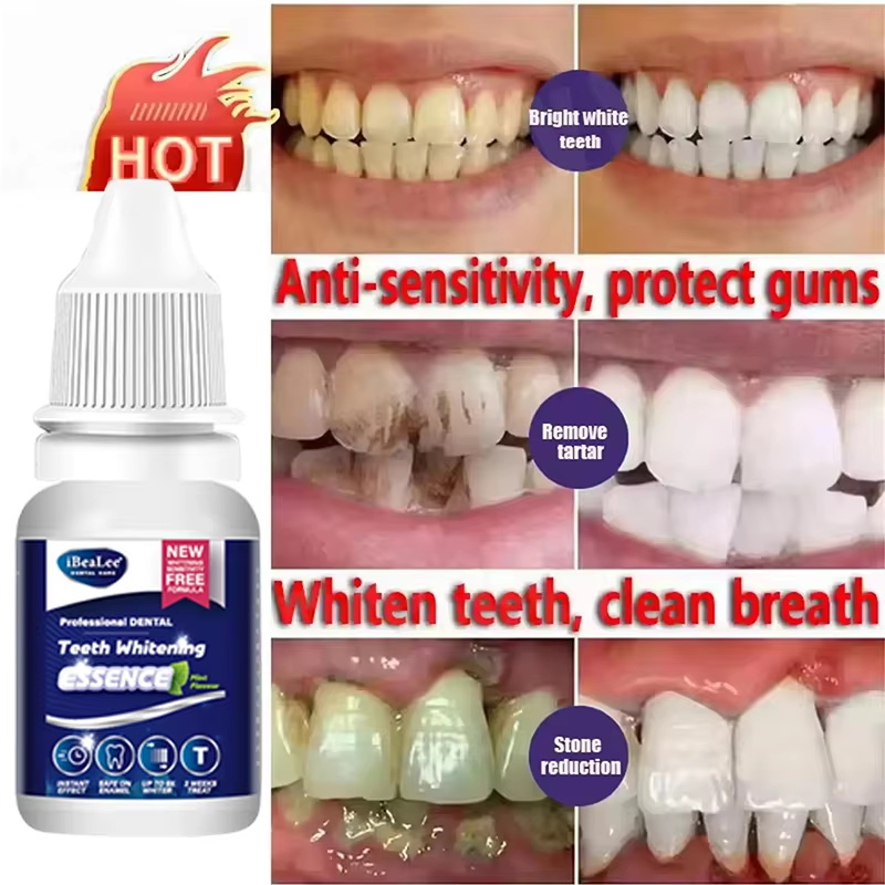 Teeth Whitening Essence Remove - Teeth Whitening Serum 评论和价格