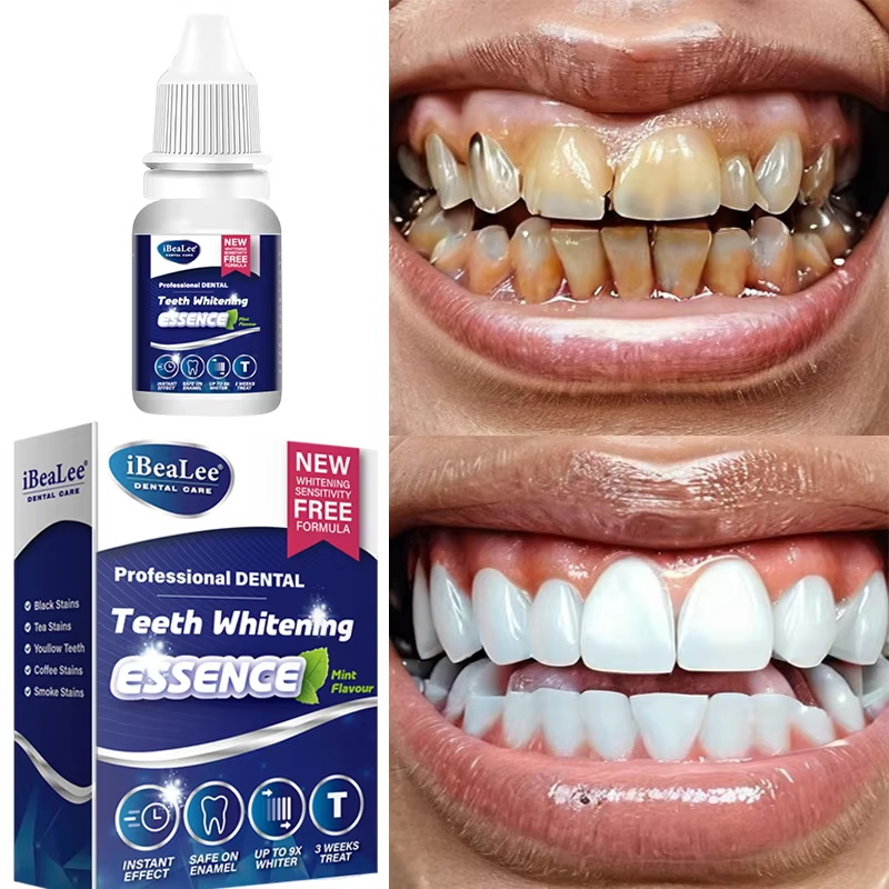 Teeth Whitening Essence Remove - Teeth Whitening Serum 评论和价格