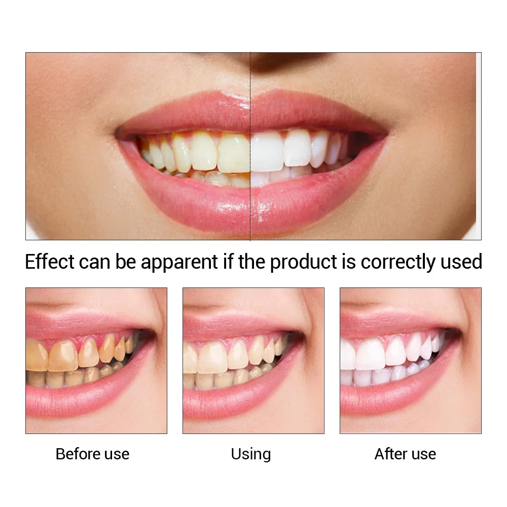 FTEENPLY Teeth Whitening Essen - Teeth Whitening Paste 评论和价格