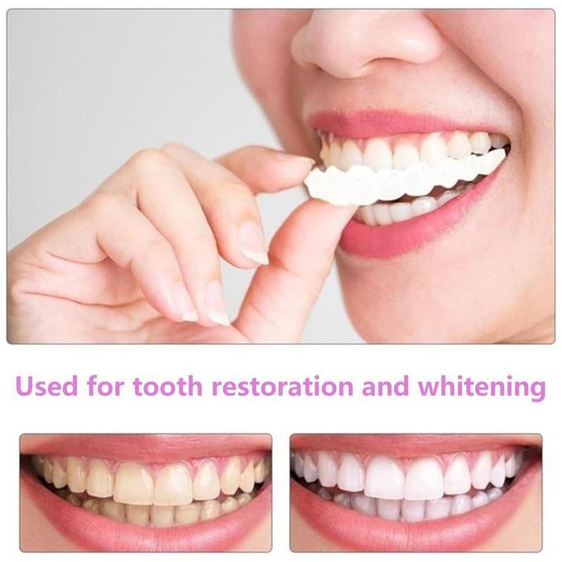 Snap On Teeth Veneers Instant  - Teeth Whitening Veneers 评论和价格