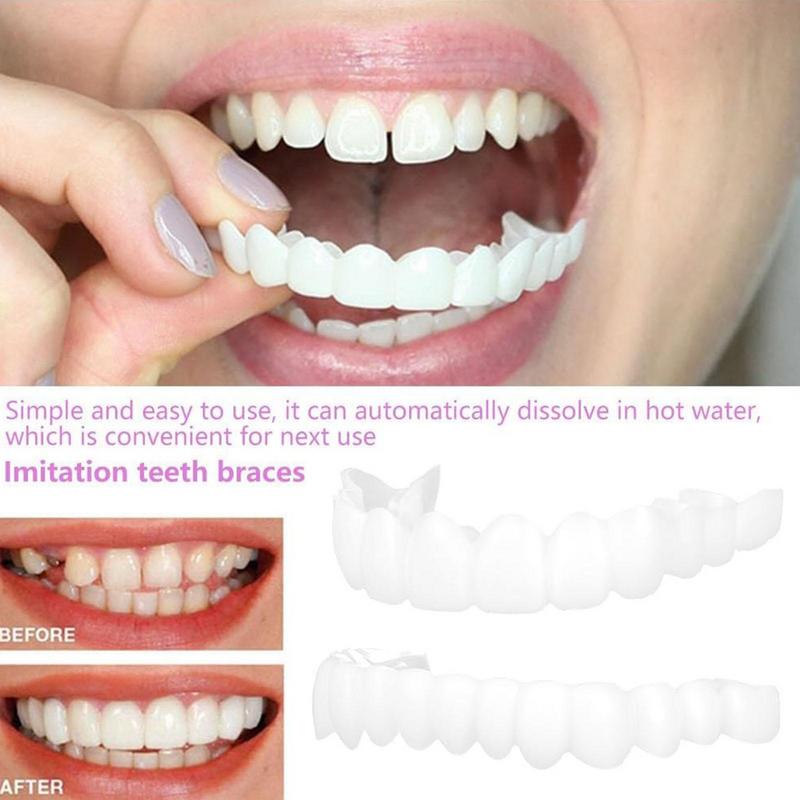 Snap On Teeth Veneers Instant  - Teeth Whitening Veneers 评论和价格