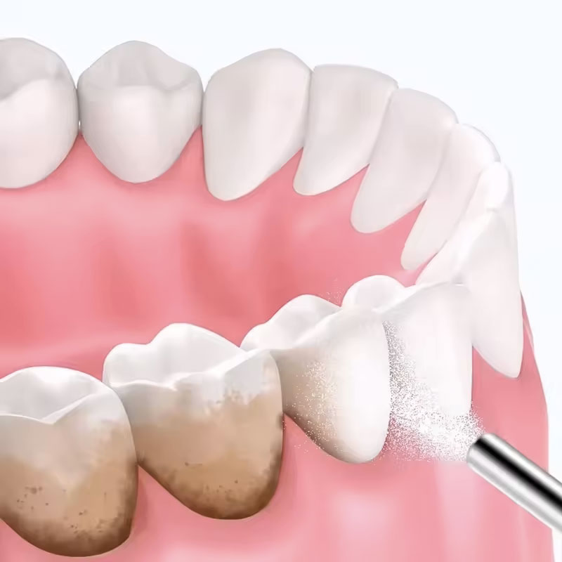 130g Dental Sandblasting Powde - Teeth Whitening Co 评论和价格