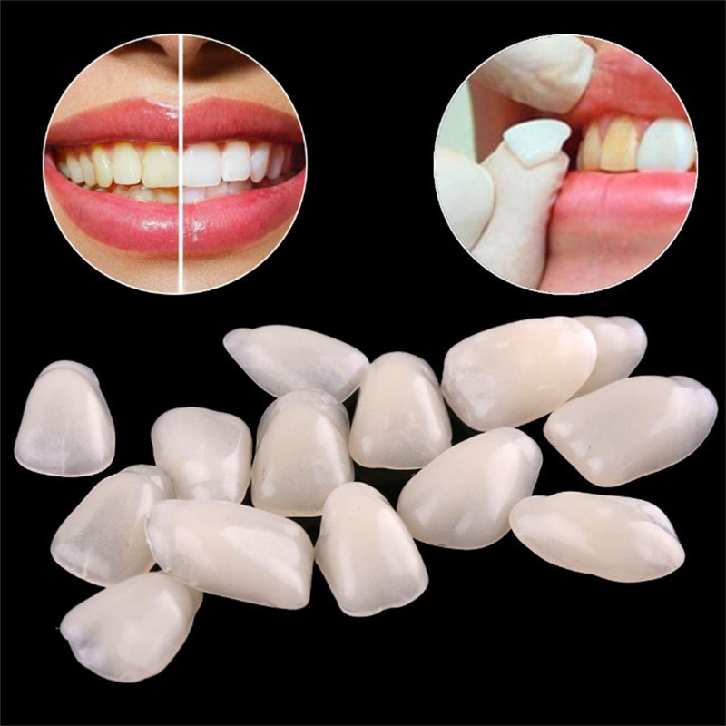 Temporary Dental Veneers - Ult - Teeth Whitening Veneers 评论和价格