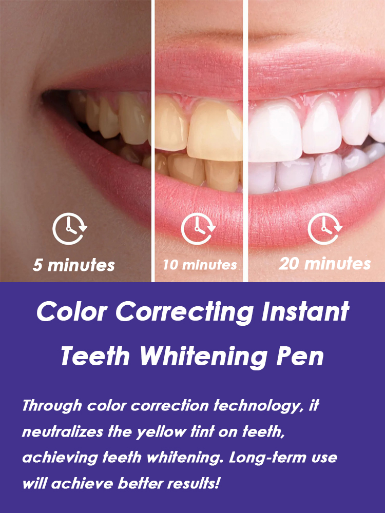 Teeth Whitening Pen Effective  - Whitening Pen Bleach 评论和价格