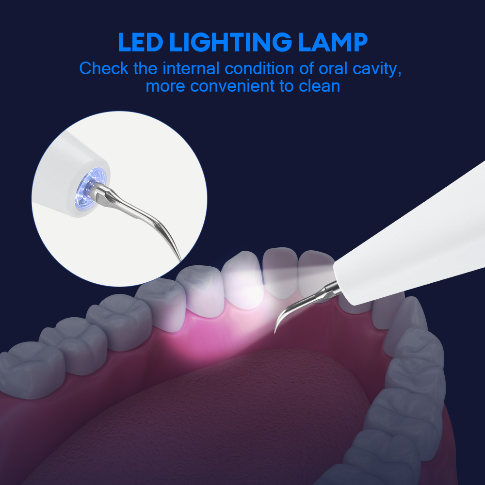 Ultrasonic Dental Calculus Rem - Teeth Whitening Strips 评论和价格
