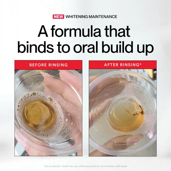 Hismile ID Whitening Stain Mou - Teeth Whitening Products 评论和价格