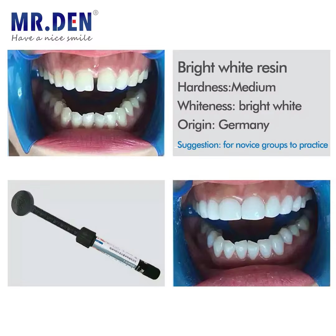 Nano Enamel Veneer Material Te - Teeth Whitening Veneers 评论和价格