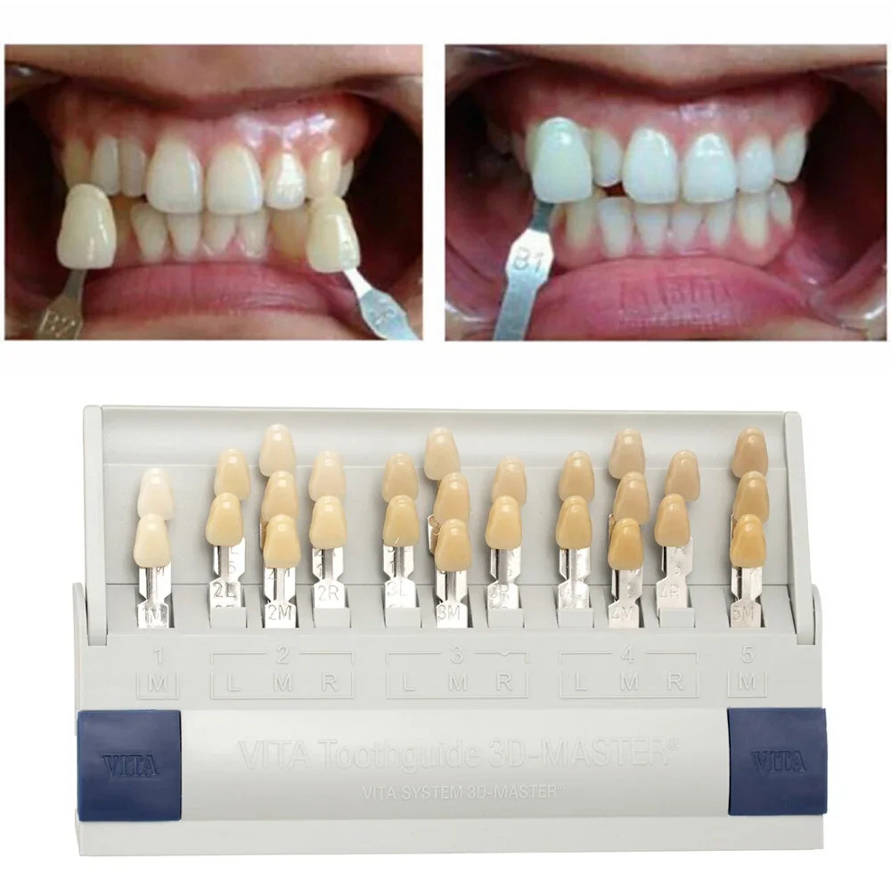 Vita 3D Master Dental Lab Blea - Teeth Whitening Shade Guide 评论和价格