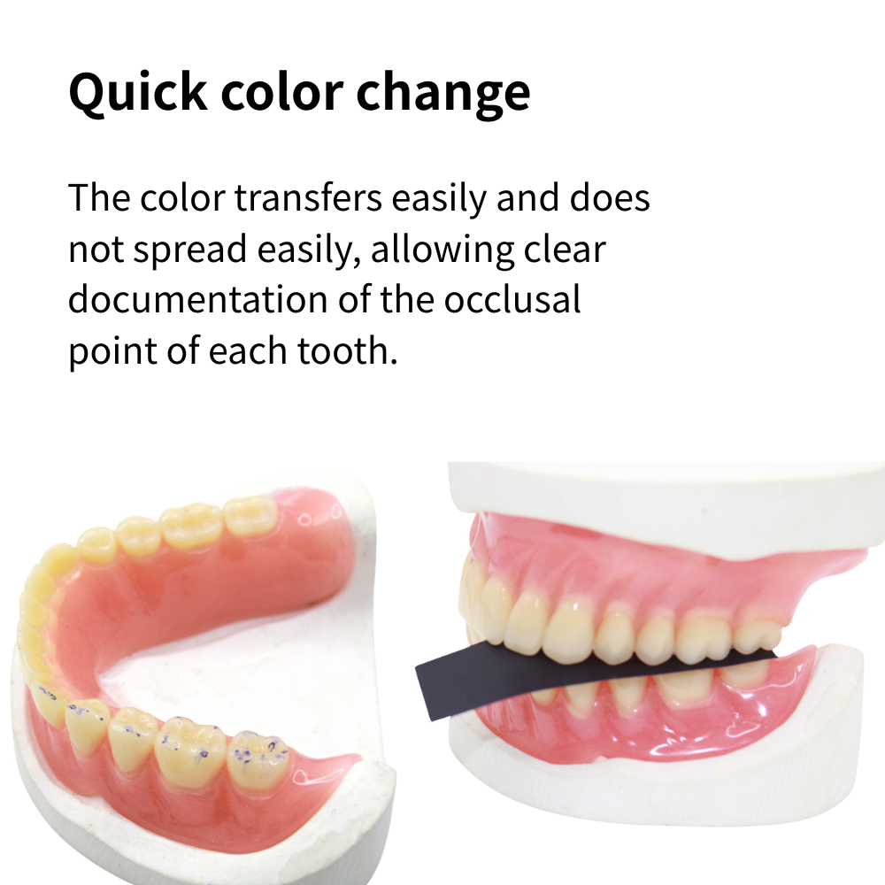 AG 300Pcs Occlusive Paper Dent - Teeth Whitening Strips 评论和价格