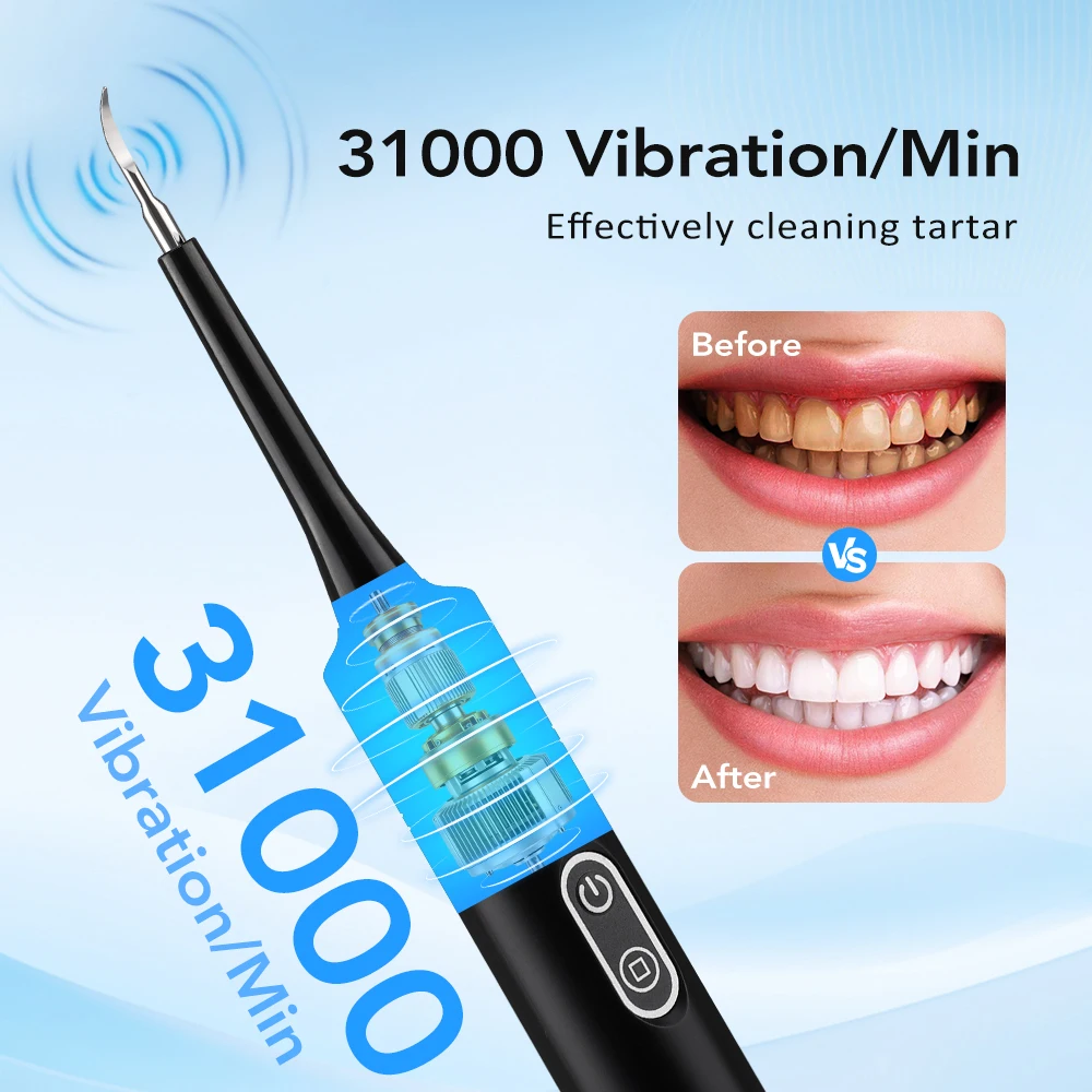 Electric Sonic Vibration Denta - Teeth Whitening Products 评论和价格